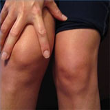 Bilateral Total Knee Replacement